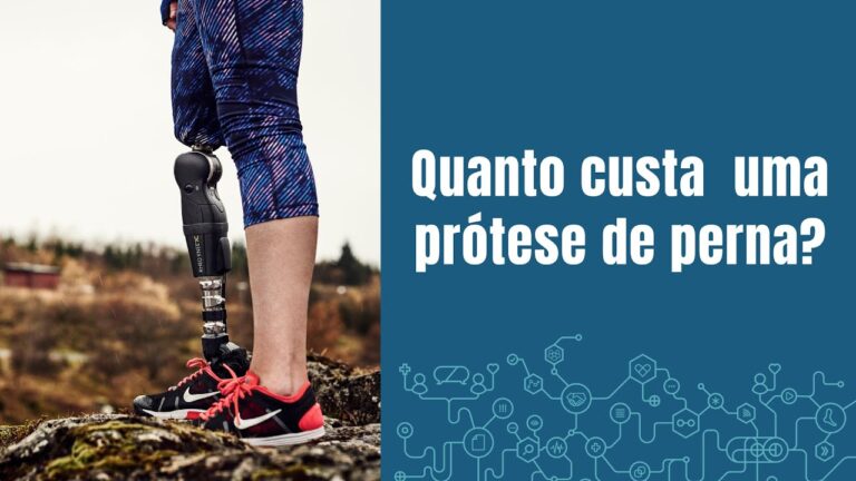 Pre&ccedil;o de Pr&oacute;tese para Perna: Guia Completo